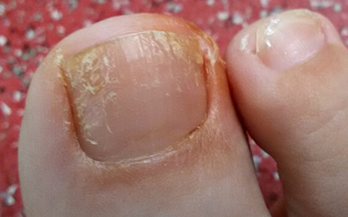 Anerer sprooch liesen